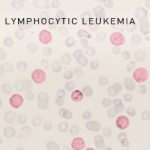Gilead Sciences Leukemie Schema
